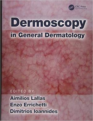 free-pdf-download-Dermoscopy in General Dermatology 1st Edition