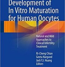 free-pdf-download-Development of In Vitro Maturation for Human Oocytes: Natural and Mild Approaches to Clinical Infertility Treatment 1st ed. 2017 Edition