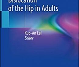 free-pdf-download-Developmental Dysplasia and Dislocation of the Hip in Adults