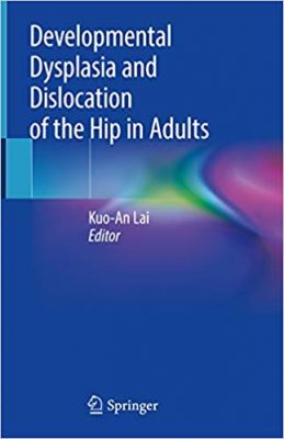 free-pdf-download-Developmental Dysplasia and Dislocation of the Hip in Adults