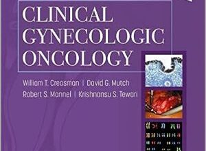 free-pdf-download-DiSaia and Creasman Clinical Gynecologic Oncology 10th Edition