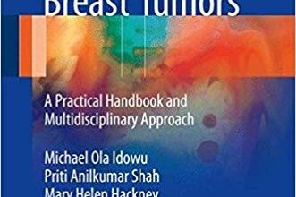 free-pdf-download-Diagnosis and Management of Breast Tumors: A Practical Handbook and Multidisciplinary Approach 1st ed. 2018 Edition