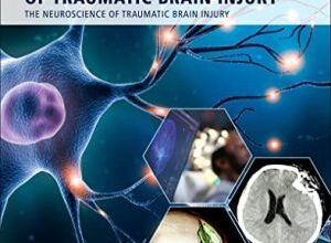 free-pdf-download-Diagnosis and Treatment of Traumatic Brain Injury