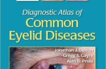 free-pdf-download-Diagnostic Atlas of Common Eyelid Diseases 1st Edition