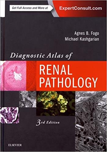 free-pdf-download-Diagnostic Atlas of Renal Pathology