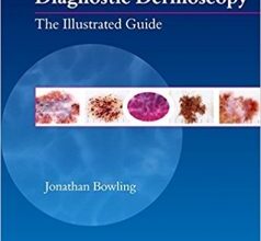 free-pdf-download-Diagnostic Dermoscopy: The Illustrated Guide 1st Edition