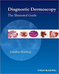 free-pdf-download-Diagnostic Dermoscopy: The Illustrated Guide 1st Edition