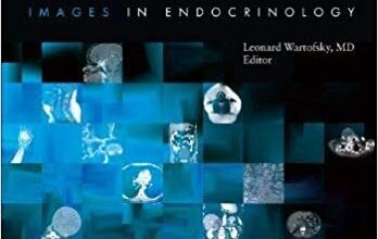 free-pdf-download-Diagnostic Dilemmas: Images In Endocrinology Volume 2 by The Endocrine Society