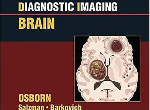 free-pdf-download-Diagnostic Imaging: Brain 2nd Edition