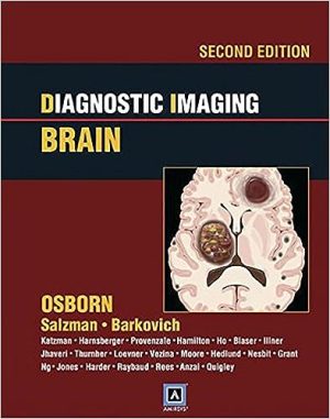 free-pdf-download-Diagnostic Imaging: Brain 2nd Edition