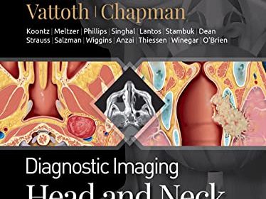 free-pdf-download-Diagnostic Imaging: Head and Neck 4th Edition