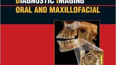 free-pdf-download-Diagnostic Imaging: Oral and Maxillofacial