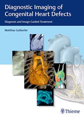 free-pdf-download-Diagnostic Imaging of Congenital Heart Defects