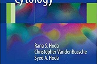 free-pdf-download-Diagnostic Liquid-Based Cytology 1st ed