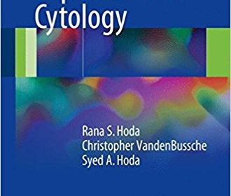 free-pdf-download-Diagnostic Liquid-Based Cytology 1st ed