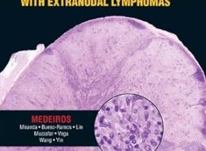 free-pdf-download-Diagnostic Pathology: Lymph Nodes and Spleen With Extranodal Lymphomas 1st Edition