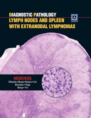 free-pdf-download-Diagnostic Pathology: Lymph Nodes and Spleen With Extranodal Lymphomas 1st Edition