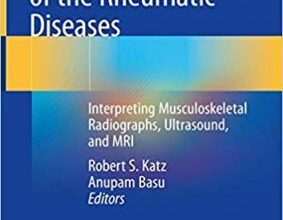 free-pdf-download-Diagnostic Radiology of the Rheumatic Diseases: Interpreting Musculoskeletal Radiographs