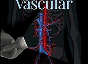 free-pdf-download-Diagnostic Ultrasound: Vascular 1st Edition