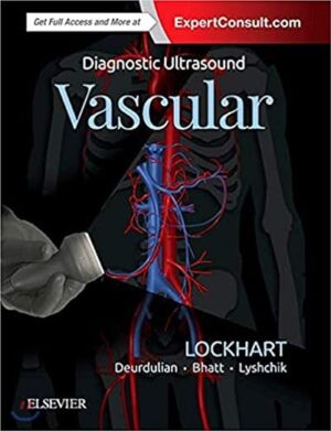 free-pdf-download-Diagnostic Ultrasound: Vascular 1st Edition