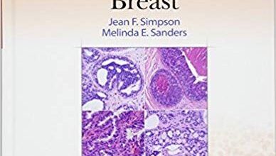 free-pdf-download-Differential Diagnoses in Surgical Pathology: Breast First Edition