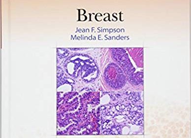 free-pdf-download-Differential Diagnoses in Surgical Pathology: Breast First Edition