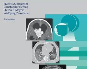 free-pdf-download-Differential Diagnosis in Computed Tomography 2nd edition