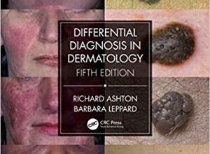 free-pdf-download-Differential Diagnosis in Dermatology 5th Edition