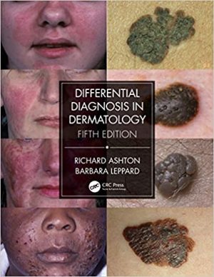 free-pdf-download-Differential Diagnosis in Dermatology 5th Edition