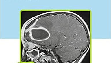 free-pdf-download-Differential Diagnosis in Neuroimaging: Brain and Meninges 1st Edition