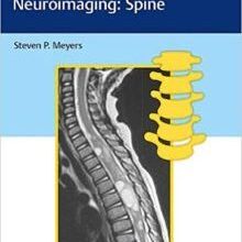 free-pdf-download-Differential Diagnosis in Neuroimaging: Spine 1st Edition