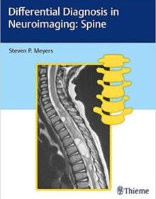 free-pdf-download-Differential Diagnosis in Neuroimaging: Spine 1st Edition