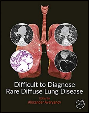 free-pdf-download-Difficult to Diagnose Rare Diffuse Lung Disease