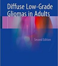 free-pdf-download-Diffuse Low-Grade Gliomas in Adults 2nd ed. 2017 Edition