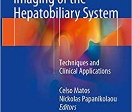 free-pdf-download-Diffusion Weighted Imaging of the Hepatobiliary System