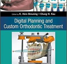 free-pdf-download-Digital Planning and Custom Orthodontic Treatment 1st Edition