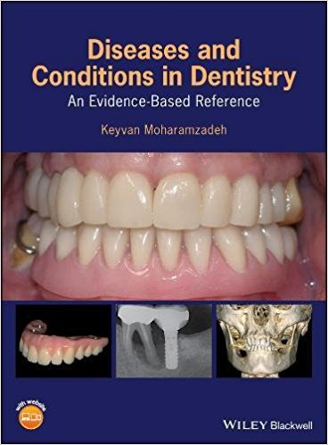 free-pdf-download-Diseases and Conditions in Dentistry: An Evidence-Based Reference 1st Edition