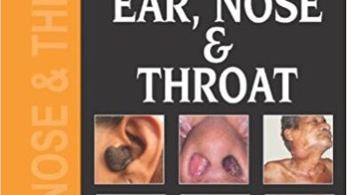 free-pdf-download-Diseases of Ear