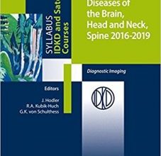 free-pdf-download-Diseases of the Brain