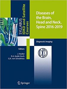 free-pdf-download-Diseases of the Brain