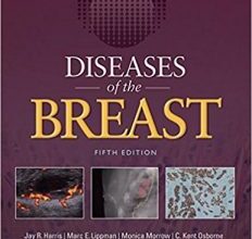 free-pdf-download-Diseases of the Breast 5e Fifth Edition