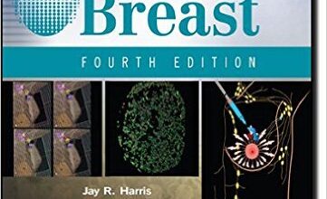 free-pdf-download-Diseases of the Breast (Diseases of the Breast (Harris)) Fourth Edition