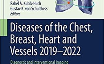 free-pdf-download-Diseases of the Chest