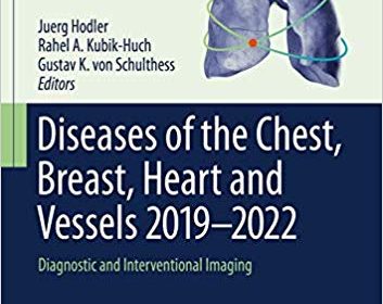 free-pdf-download-Diseases of the Chest