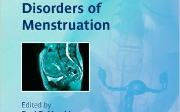 free-pdf-download-Disorders of Menstruation 1st Edition