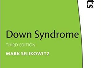 free-pdf-download-Down Syndrome (The Facts Series)