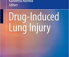 free-pdf-download-Drug-Induced Lung Injury