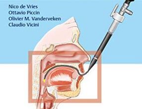 free-pdf-download-Drug-Induced Sleep Endoscopy: Diagnostic and Therapeutic Applications