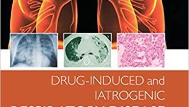 free-pdf-download-Drug-induced and Iatrogenic Respiratory Disease