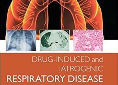 free-pdf-download-Drug-induced and Iatrogenic Respiratory Disease